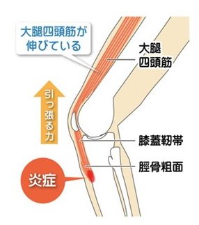 かがやき鍼灸整骨院